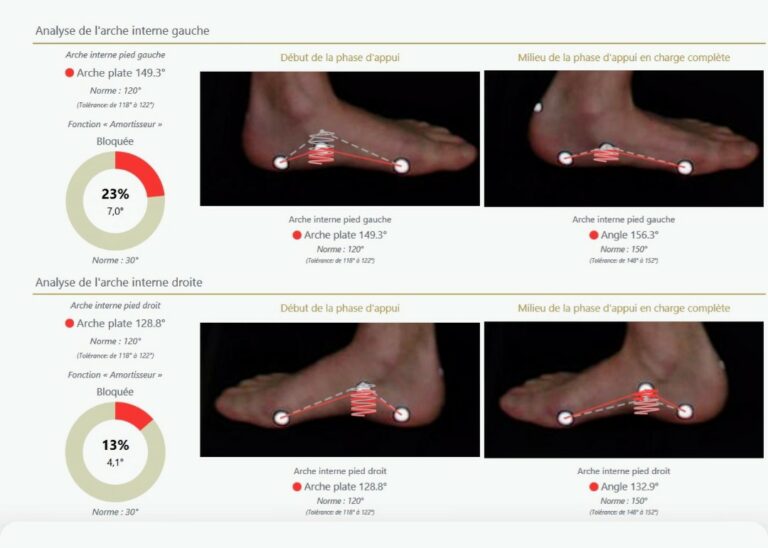 Lire la suite à propos de l’article Bilan postural  : Évaluation biomécanique de la posture et des pieds ayant pour causes des pathologies de pied telles que la fasciite plantaire, les épines calcanéennes, l’ hallux valgus, le syndrome de morton…