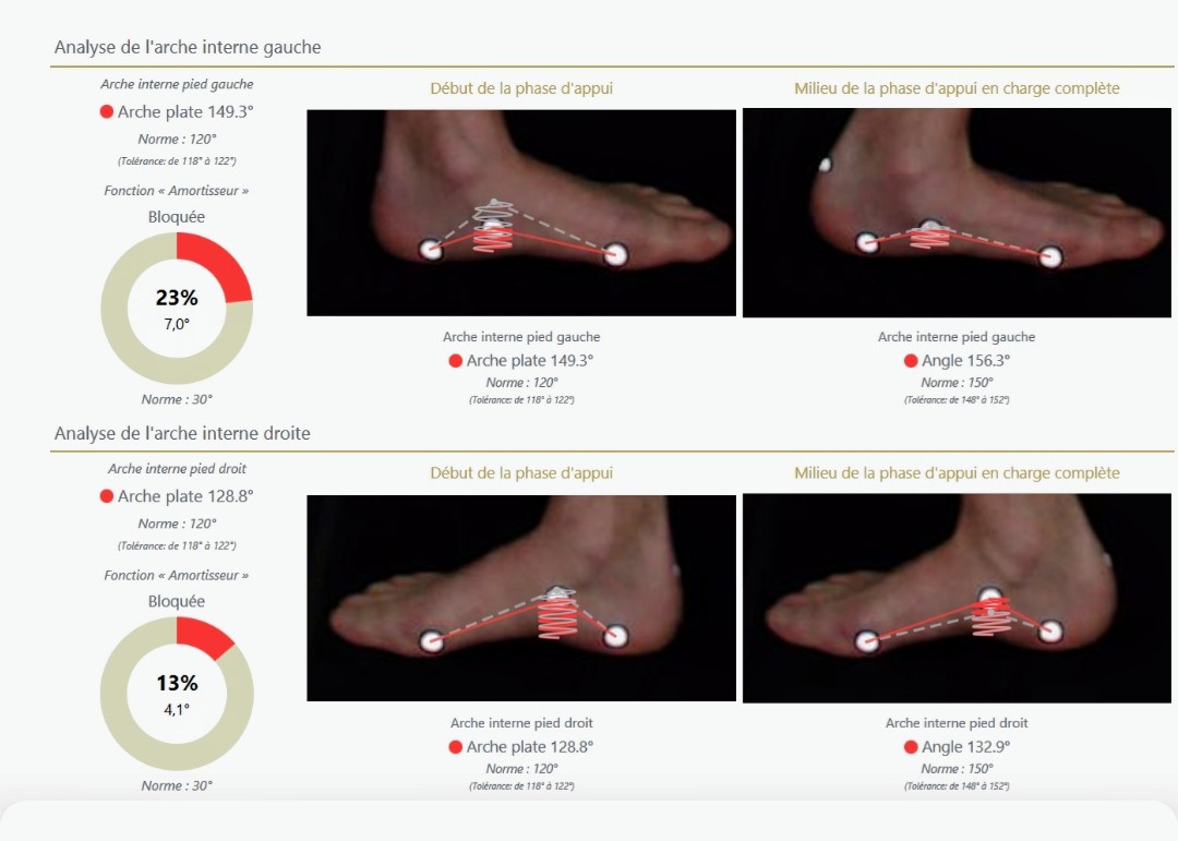 Lire la suite à propos de l’article Bilan postural  : Évaluation biomécanique de la posture et des pieds ayant pour causes des pathologies de pied telles que la fasciite plantaire, les épines calcanéennes, l’ hallux valgus, le syndrome de morton…
